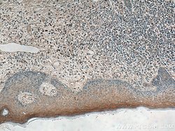 IL36RN Rabbit anti-Human, Polyclonal, Proteintech:Antibodies:Primary Antibodies