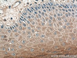 IL36RN Rabbit anti-Human, Polyclonal, Proteintech:Antibodies:Primary Antibodies