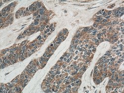 IL36RN Rabbit anti-Human, Polyclonal, Proteintech:Antibodies:Primary Antibodies