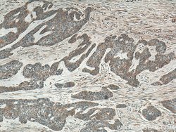 IL36RN Rabbit anti-Human, Polyclonal, Proteintech:Antibodies:Primary Antibodies