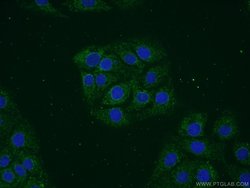 VAMP1 Rabbit anti-Human, Mouse, Rat, Polyclonal, Proteintech:Antibodies:Primary