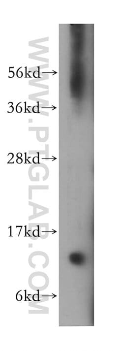 VAMP1 Rabbit anti-Human, Mouse, Rat, Polyclonal, Proteintech:Antibodies:Primary
