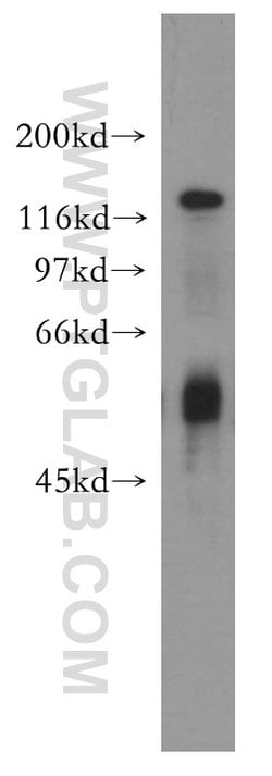 TEAD3 Rabbit anti-Human, Mouse, Polyclonal, Proteintech