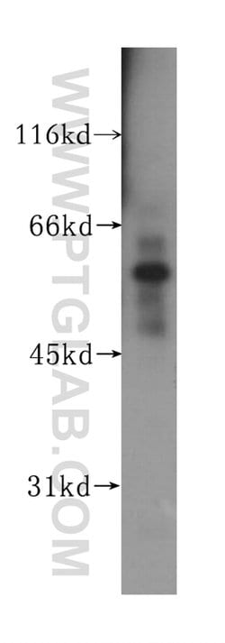 TEAD3 Rabbit anti-Human, Mouse, Polyclonal, Proteintech:Antibodies:Primary