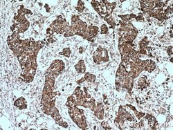 ACADSB Rabbit anti-Human, Mouse, Rat, Polyclonal, Proteintech 150 &mu;L;