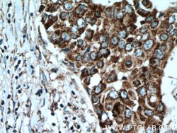 ACADSB Rabbit anti-Human, Mouse, Rat, Polyclonal, Proteintech 150 &mu;L;