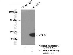 ACADSB Rabbit anti-Human, Mouse, Rat, Polyclonal, Proteintech 150 &mu;L;