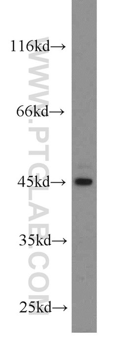 ACADSB Rabbit anti-Human, Mouse, Rat, Polyclonal, Proteintech 150 &mu;L;