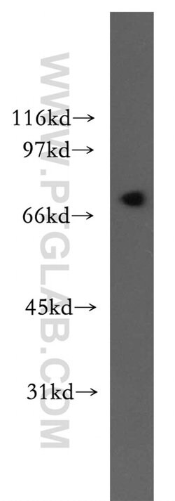 LNX1 Rabbit anti-Human, Mouse, Rat, Polyclonal, Proteintech 150 &mu;L;