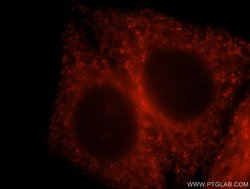 USP24 Rabbit anti-Human, Mouse, Polyclonal, Proteintech:Antibodies:Primary