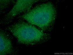 USP24 Rabbit anti-Human, Mouse, Polyclonal, Proteintech:Antibodies:Primary