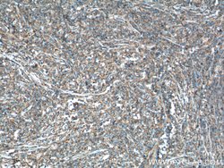 USP24 Rabbit anti-Human, Mouse, Polyclonal, Proteintech:Antibodies:Primary