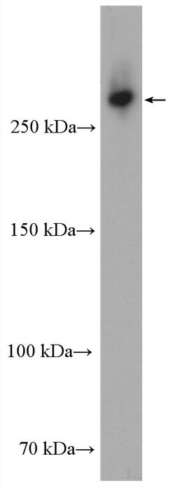 USP24 Rabbit anti-Human, Mouse, Polyclonal, Proteintech:Antibodies:Primary