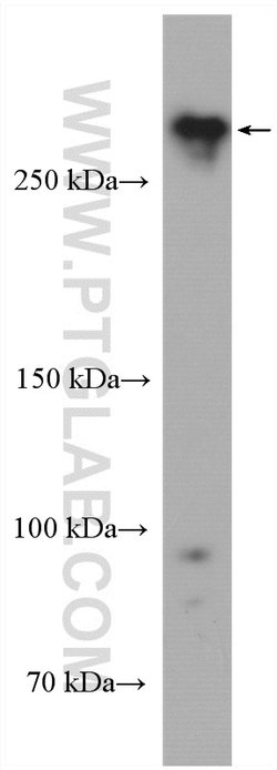 USP24 Rabbit anti-Human, Mouse, Polyclonal, Proteintech:Antibodies:Primary