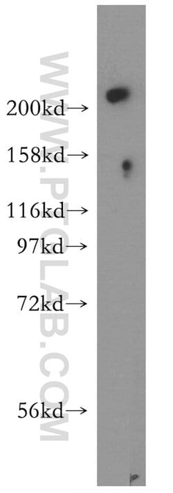 USP24 Rabbit anti-Human, Mouse, Polyclonal, Proteintech:Antibodies:Primary