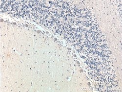 TrkB Rabbit anti-Human, Mouse, Porcine, Rat, Polyclonal, Proteintech 150