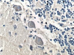 TrkB Rabbit anti-Human, Mouse, Porcine, Rat, Polyclonal, Proteintech 150