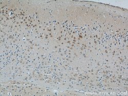 MINK1 Rabbit anti-Human, Mouse, Rat, Polyclonal, Proteintech:Antibodies:Primary