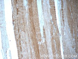 MINK1 Rabbit anti-Human, Mouse, Rat, Polyclonal, Proteintech:Antibodies:Primary