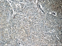 MINK1 Rabbit anti-Human, Mouse, Rat, Polyclonal, Proteintech:Antibodies:Primary