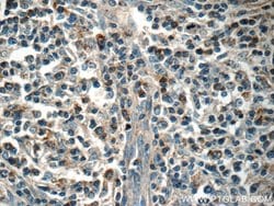 MINK1 Rabbit anti-Human, Mouse, Rat, Polyclonal, Proteintech:Antibodies:Primary
