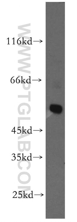 GLRA3 Rabbit anti-Human, Mouse, Rat, Polyclonal, Proteintech:Antibodies:Primary