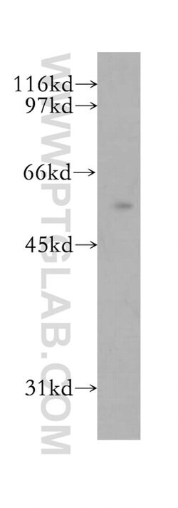 ZC3HC1 Rabbit anti-Human, Mouse, Rat, Polyclonal, Proteintech:Antibodies:Primary