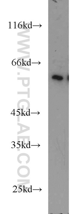 ZC3HC1 Rabbit anti-Human, Mouse, Rat, Polyclonal, Proteintech:Antibodies:Primary