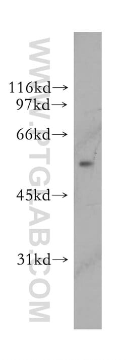 UGDH Rabbit anti-Human, Mouse, Rat, Polyclonal, Proteintech 150 &mu;L;
