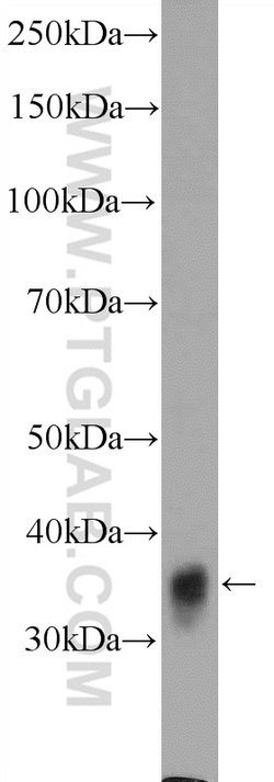 GDAP1 Rabbit anti-Human, Mouse, Polyclonal, Proteintech:Antibodies:Primary