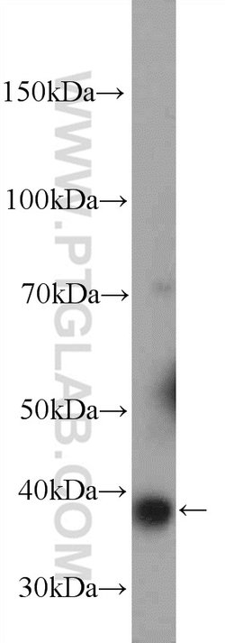 GDAP1 Rabbit anti-Human, Mouse, Polyclonal, Proteintech:Antibodies:Primary