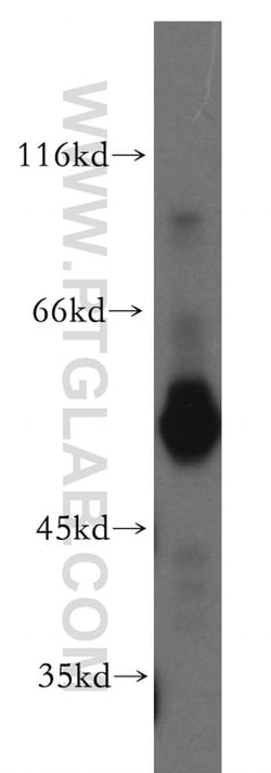 ST3GAL6 Rabbit anti-Human, Mouse, Rat, Polyclonal, Proteintech 150 &mu;L;