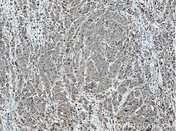 DNAJB9 Rabbit anti-Human, Mouse, Rat, Polyclonal, Proteintech:Antibodies:Primary