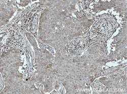 Proteintech DNAJB9 Rabbit anti-Human, Mouse, Rat, Polyclonal, Proteintech