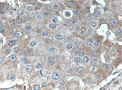 DNAJB9 Rabbit anti-Human, Mouse, Rat, Polyclonal, Proteintech:Antibodies:Primary