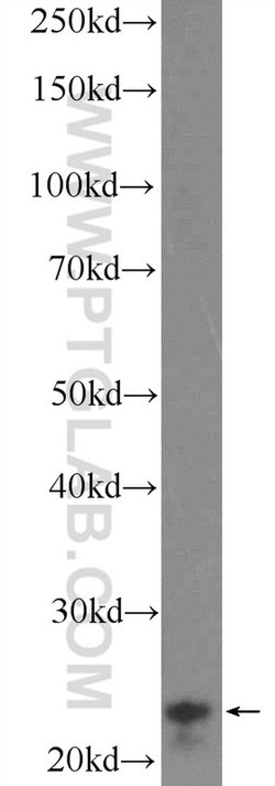 DNAJB9 Rabbit anti-Human, Mouse, Rat, Polyclonal, Proteintech:Antibodies:Primary