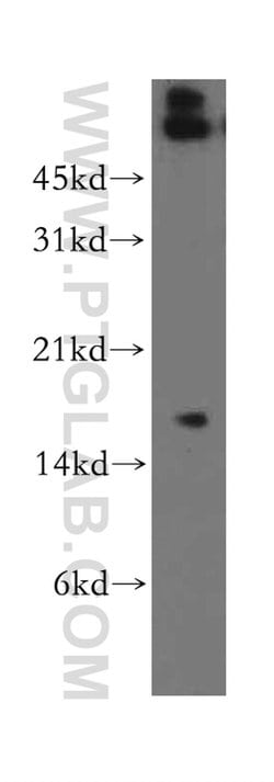 MPZL1 Rabbit anti-Human, Mouse, Rat, Polyclonal, Proteintech 20 &mu;L;