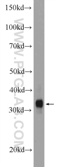 MYOZ1 Rabbit anti-Human, Mouse, Rat, Polyclonal, Proteintech:Anticuerpos:Anticuerpos
