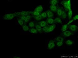 SIRT1 Rabbit anti-Human, Polyclonal, Proteintech:Antibodies:Primary Antibodies