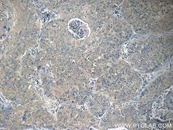 SIRT1 Rabbit anti-Human, Polyclonal, Proteintech:Antibodies:Primary Antibodies