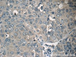 SIRT1 Rabbit anti-Human, Polyclonal, Proteintech:Antibodies:Primary Antibodies