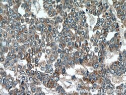 SIRT1 Rabbit anti-Human, Polyclonal, Proteintech:Antibodies:Primary Antibodies