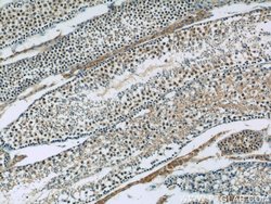 SIRT1 Rabbit anti-Human, Polyclonal, Proteintech:Antibodies:Primary Antibodies