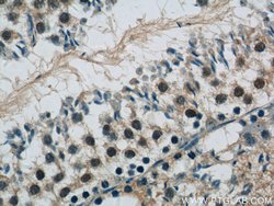 SIRT1 Rabbit anti-Human, Polyclonal, Proteintech:Antibodies:Primary Antibodies