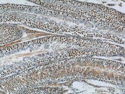 SIRT1 Rabbit anti-Human, Polyclonal, Proteintech:Antibodies:Primary Antibodies