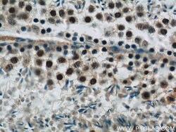 SIRT1 Rabbit anti-Human, Polyclonal, Proteintech:Antibodies:Primary Antibodies