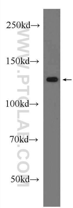 SIRT1 Rabbit anti-Human, Polyclonal, Proteintech:Antibodies:Primary Antibodies