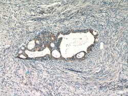 RASGRP3 Rabbit anti-Human, Mouse, Polyclonal, Proteintech:Antibodies:Primary