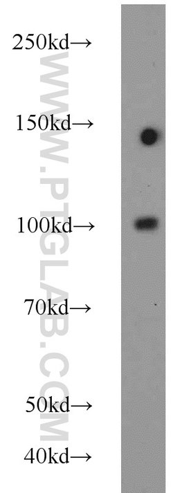 PSMA/GCPII Rabbit anti-Human, Mouse, Rat, Polyclonal, Proteintech:Antibodies:Primary