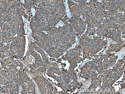 PSMA/GCPII Rabbit anti-Human, Mouse, Rat, Polyclonal, Proteintech:Antibodies:Primary